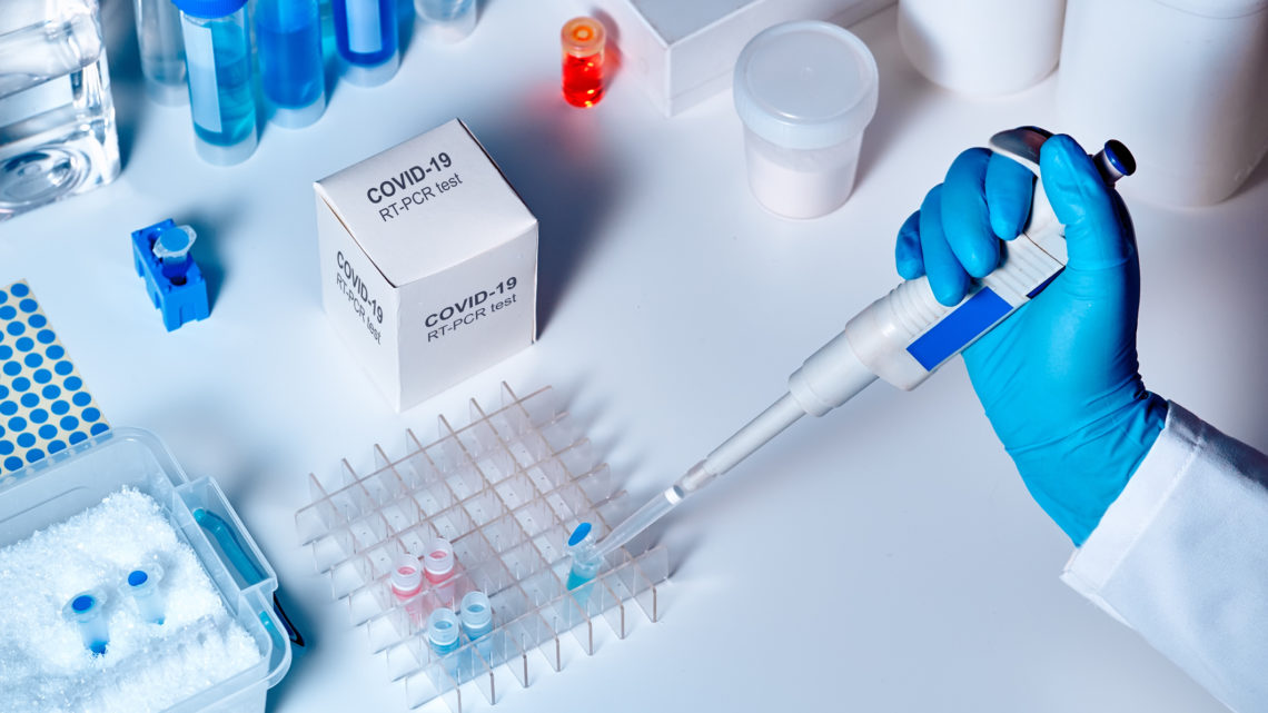 Novel coronavirus 2019 nCoV pcr diagnostics kit. This is RT-PCR kit to detect presence of 2019-nCoV or covid19 virus in clinical specimens. In vitro diagnostic test based on real-time PCR technology